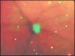 Las células moribundas se observan como puntos verdes en la retina del ratón.