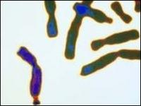 El síndrome se caracteriza por un cromosoma X curvado.
