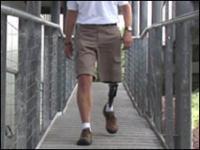 La prótesis de pie ayuda al amputado a caminar de forma más natural.