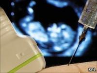 La amniocentesis requiere insertar una aguja larga en el útero.